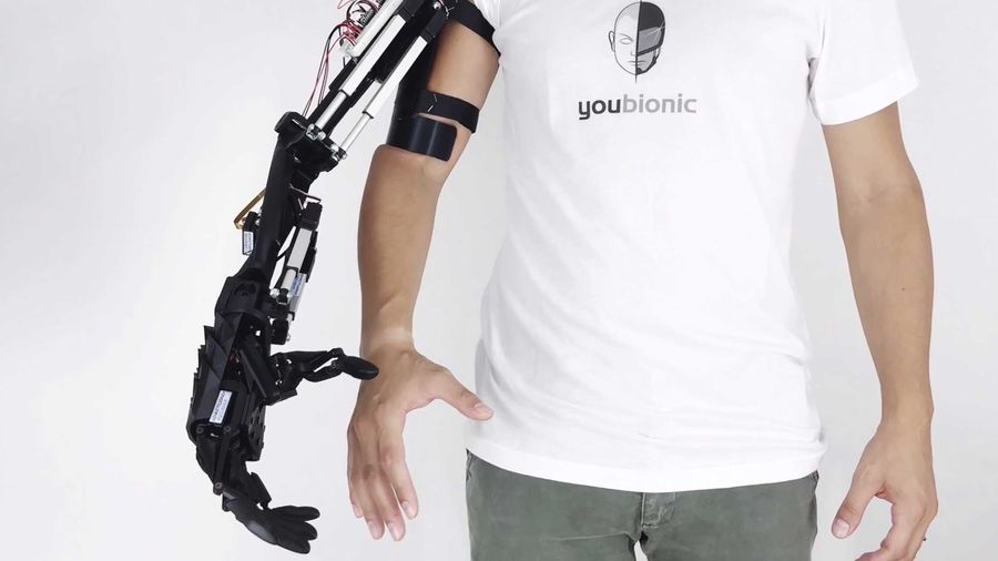 Youbionic arm