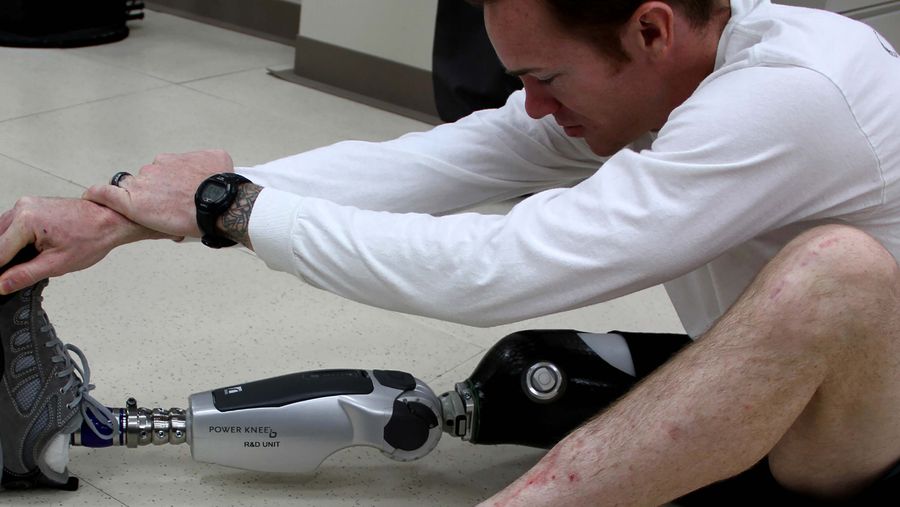 robotic leg