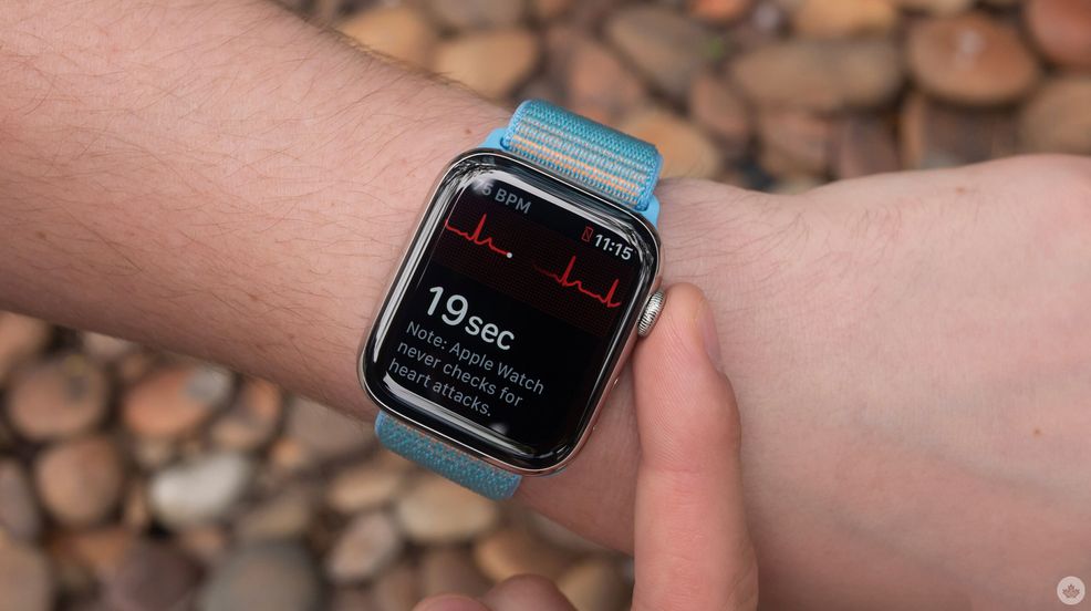 Select Apple Watch models now on sale for Amazon Prime Day