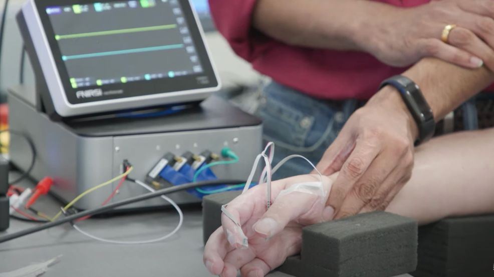 AI-brain implant helped patient gain feeling in his hand again